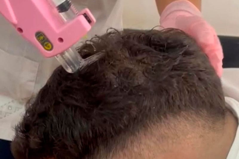 Tratamientos Capilares