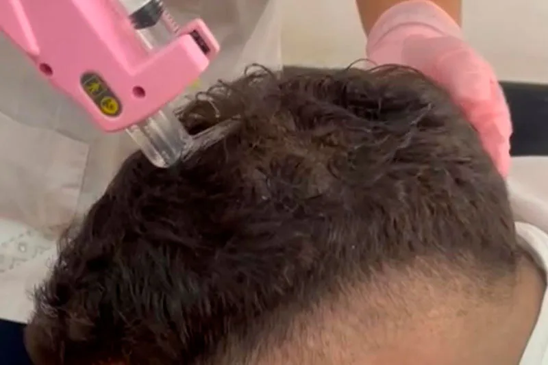 Tratamientos capilares