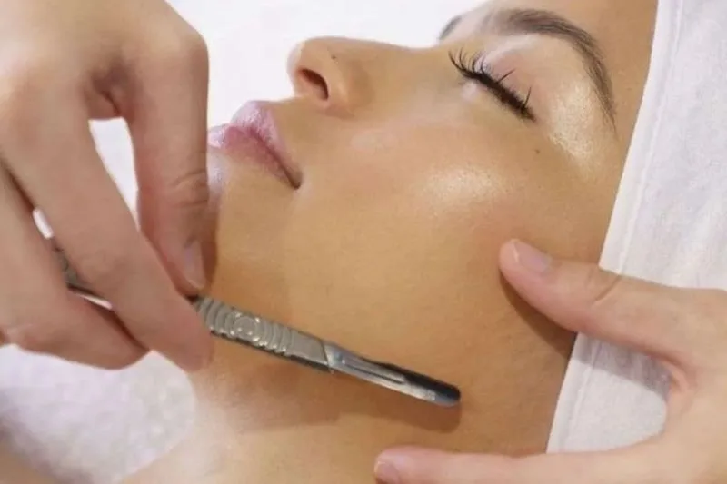 Dermaplaning y peelings