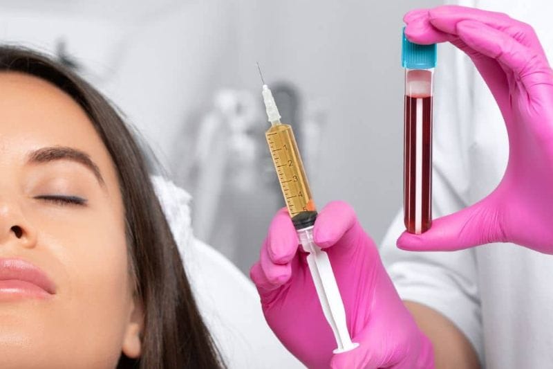 Plasma Rico en Plaquetas