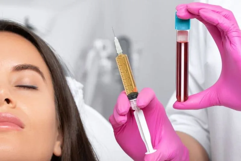 Plasma rico en plaquetas