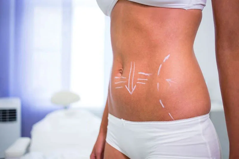 HIFU + Radiofrecuencia + Liposonix